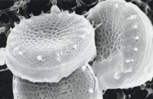 diatom-stephanodiscus-hantzscii
